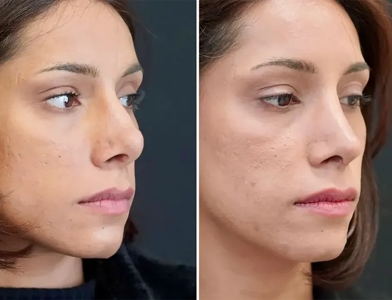 نمونه کار دکتر حامد محمدی