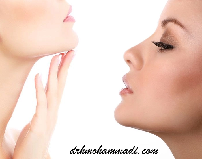 روش‌های جراحی چانه