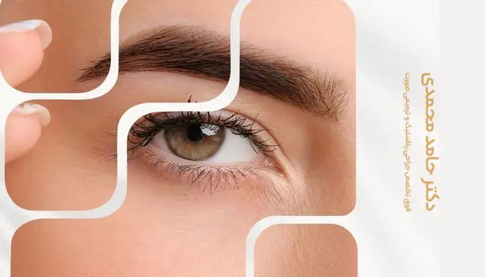 عمل لیفت ابرو