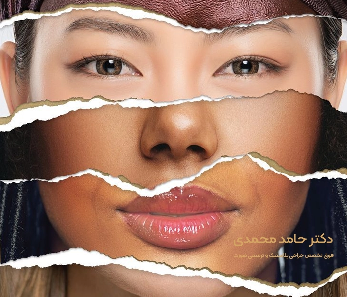 نحوه تشخیص بهترین نوع جراحی با توجه به چهره هر فرد