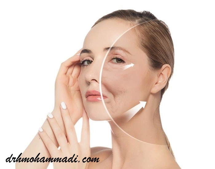 تخلیه چربی لپ ها