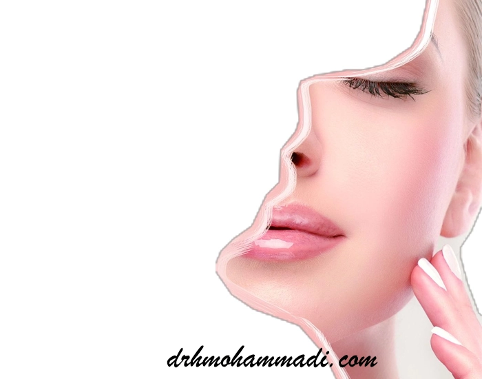 جراحی بوکال فت 