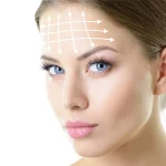 جراحی لیفت شقیقه