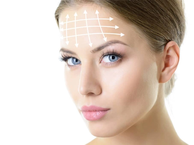 جراحی لیفت شقیقه