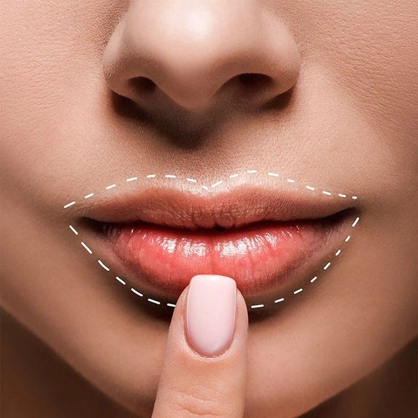 کاندیدای مناسب جراحی لیفت لب