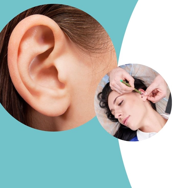 کاندیدهای مناسب برای اتوپلاستی