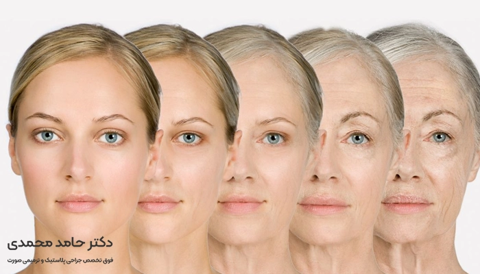 سن مناسب برای عمل لیفت صورت