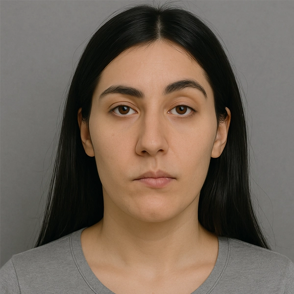 عدم تقارن صورت پس از لیفت یا پروتز