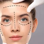 ماندگاری جراحی لیفت صورت