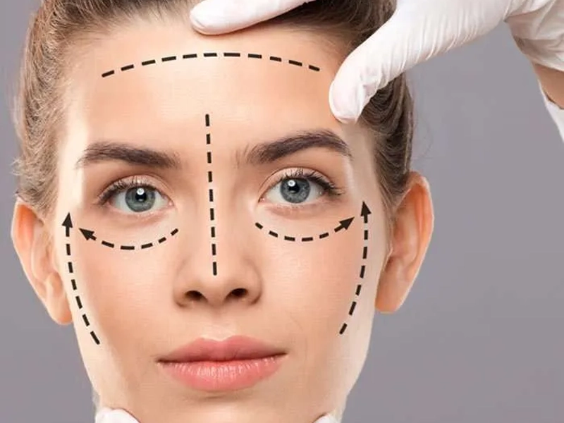 ماندگاری جراحی لیفت صورت