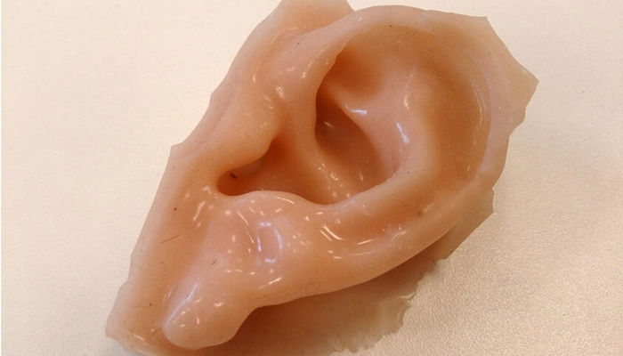 پروتز صورت چیست